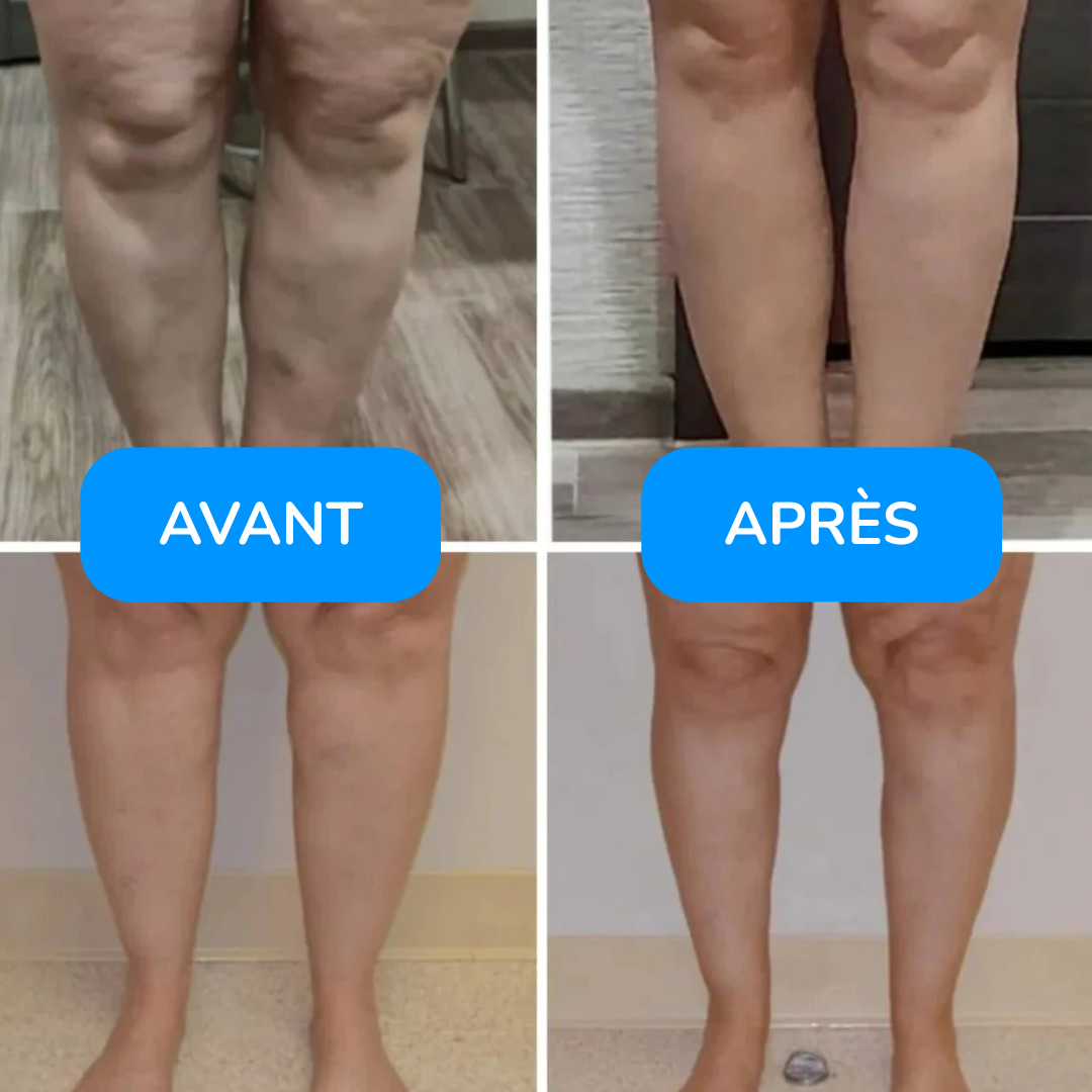 Chaussettes de compression premium – Running, voyage, récupération